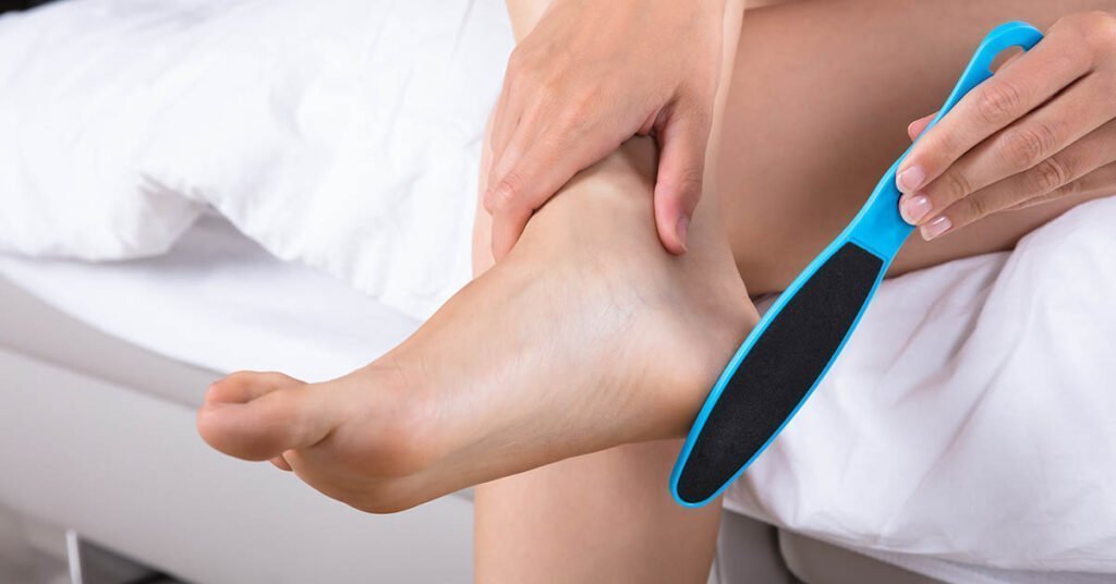 Enlever les callosités avec une lime à callosités - étapes pour traitement à domicile